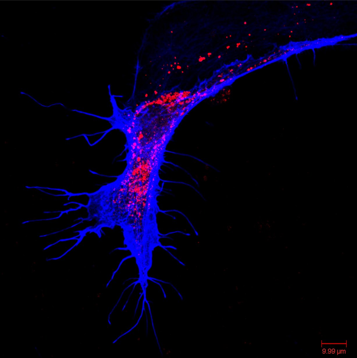 Primary fetal mouse astrocyte with elongated bipolar morphology showing lysosomal gradient from soma to process tip