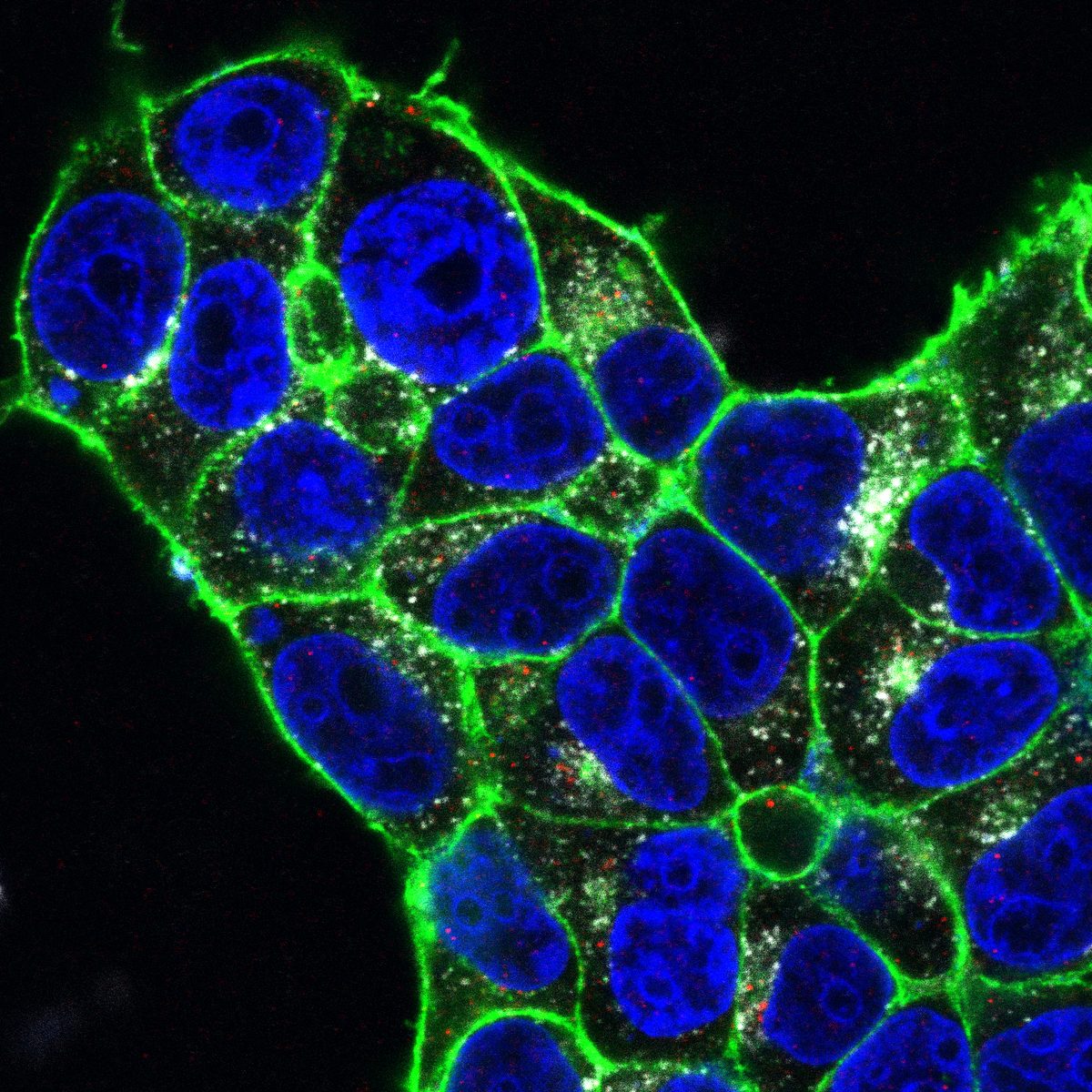 ACE2 receptor and spike protein colocalization on HEK-293T-ACE2 cells
