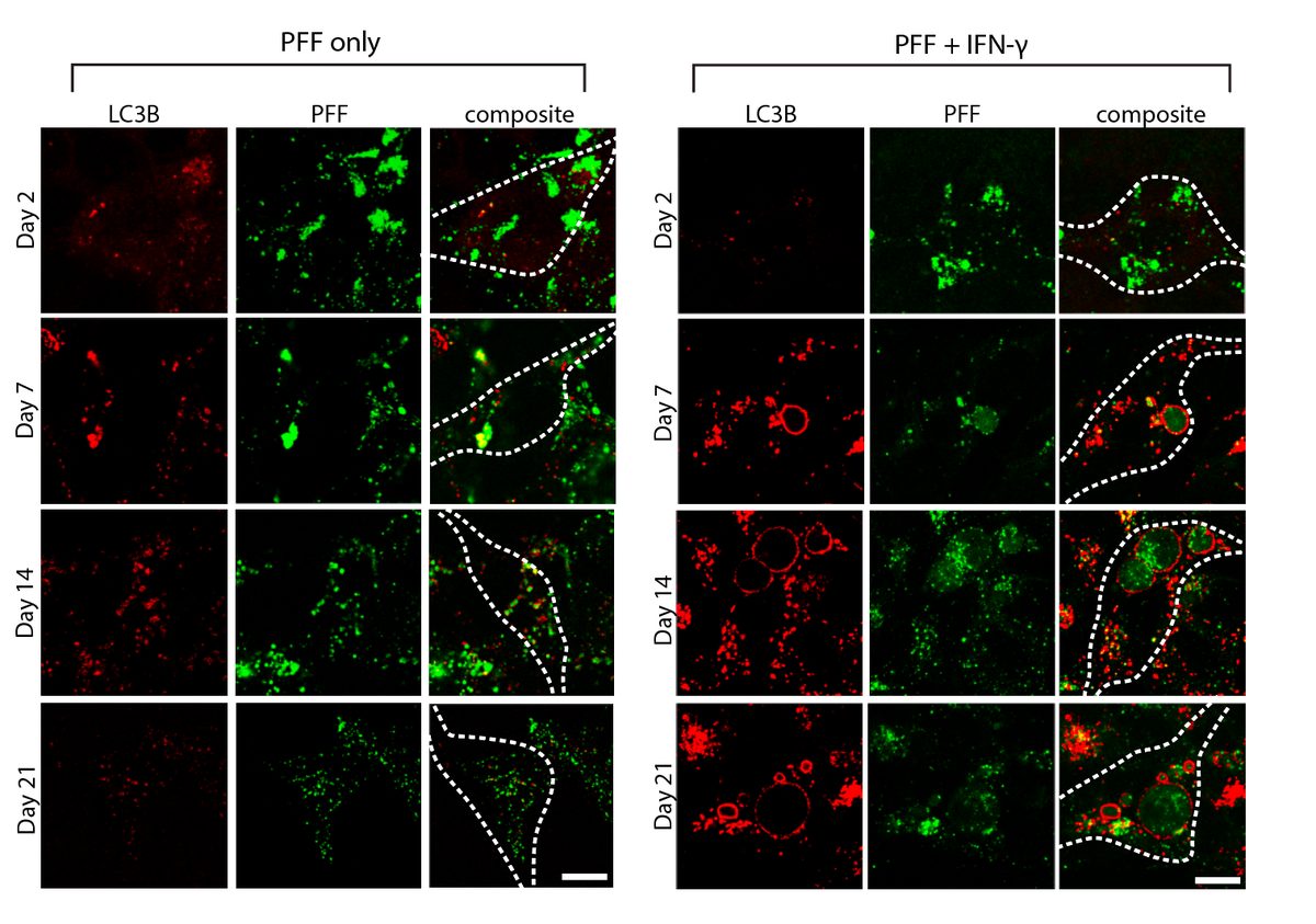 IFN-γ-induced autophagy dysregulation
