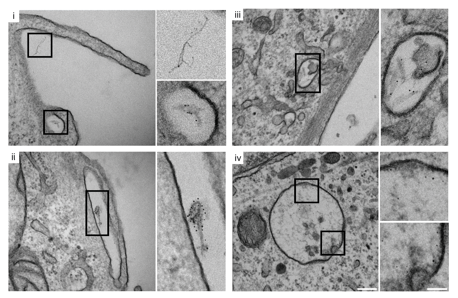 EM panels: Nanogold-labeled fibrils at plasma membrane, macropinosomes, and lysosomes