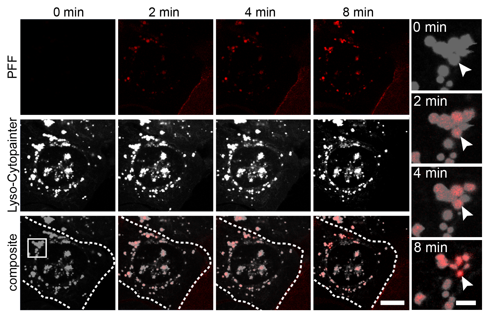 Confocal: Rapid fibril uptake and lysosomal colocalization within 2 minutes