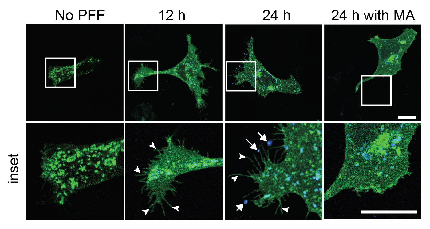 CD63-GFP membrane ruffles upon PFF exposure ± Manumycin A inhibition
