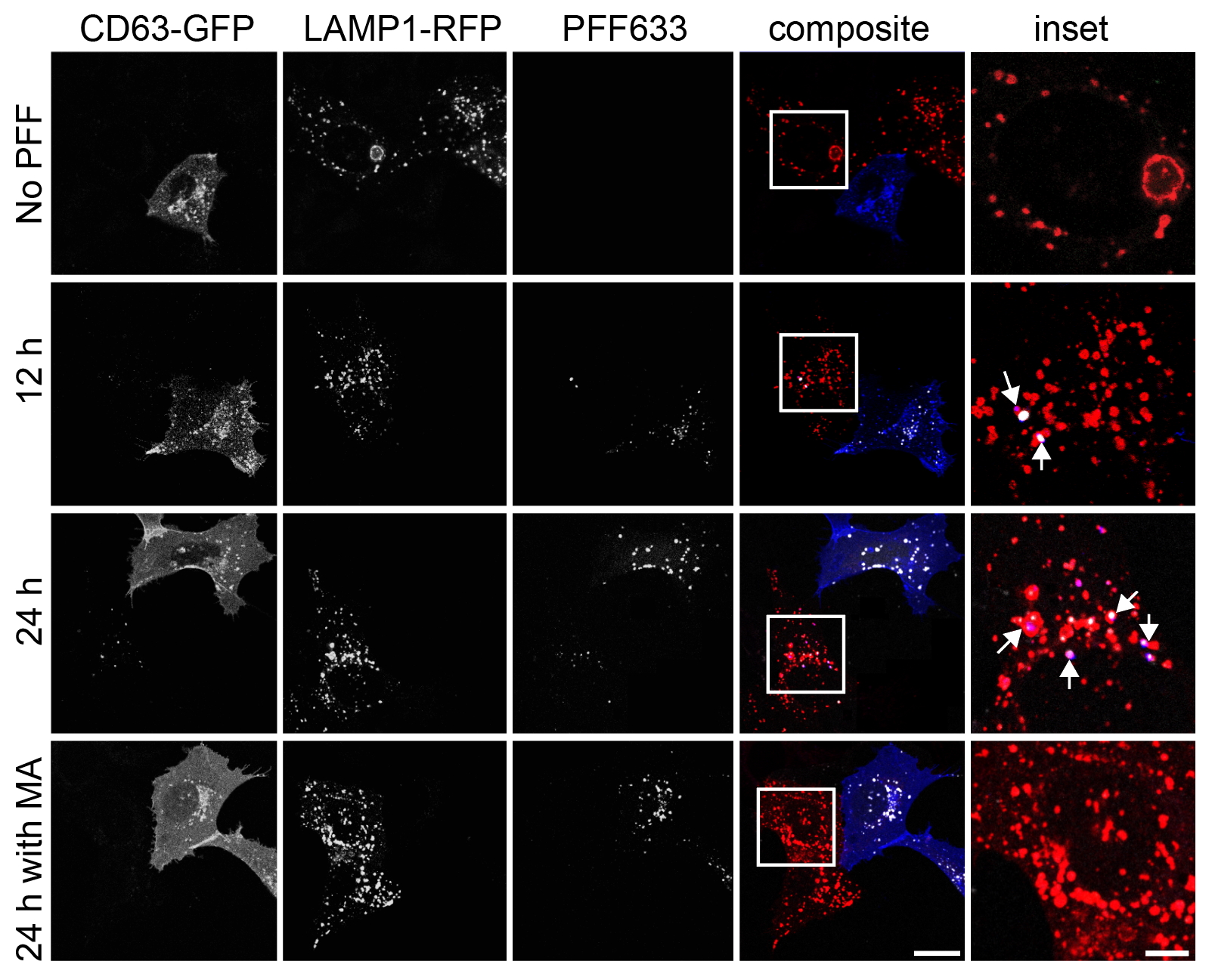 Confocal: CD63 and fibril signal transferred to naïve recipient cells