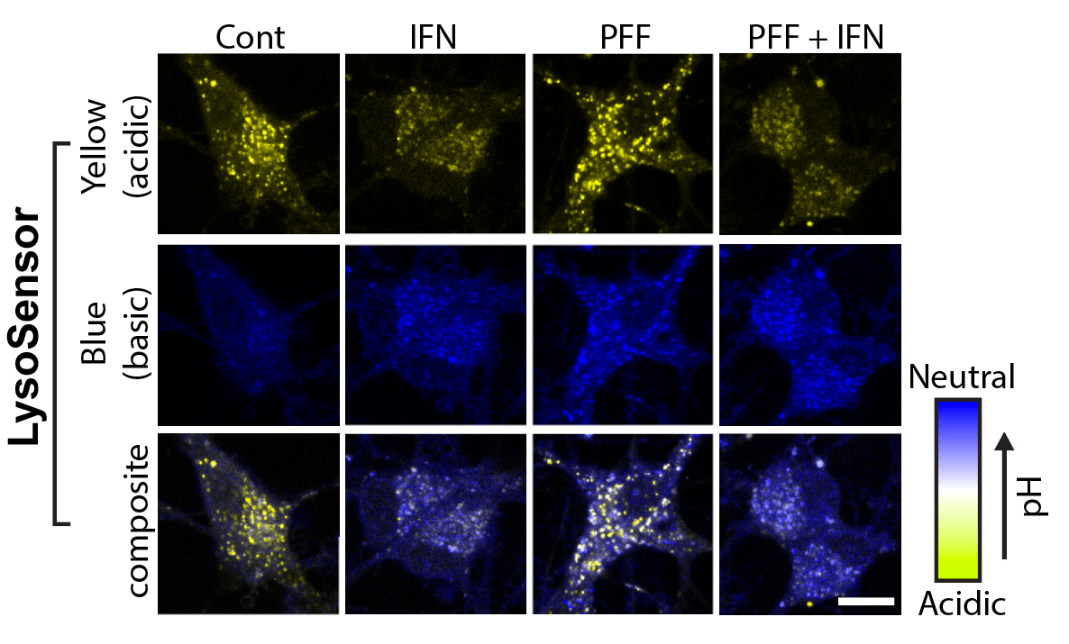 LysoSensor staining — lysosomal pH across treatment conditions