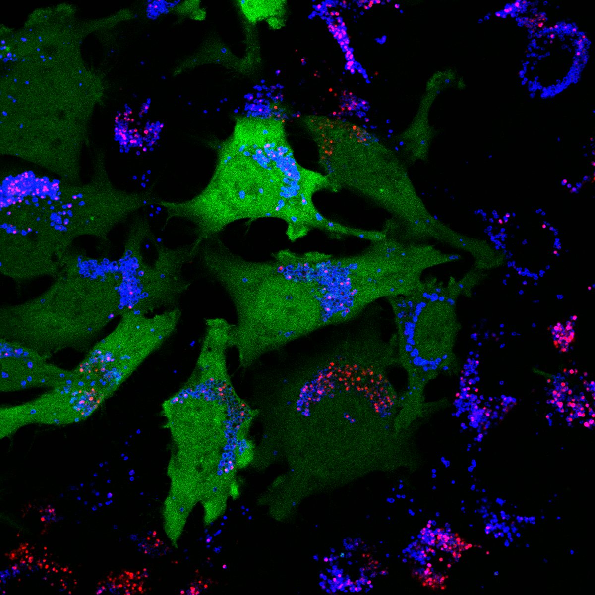 DA NPC galectin-3 puncta showing lysosomal membrane permeabilization