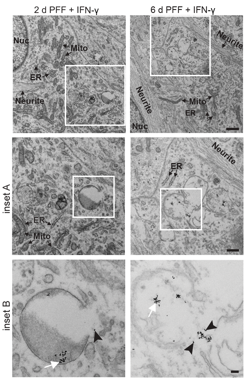 EM: fibrils inside broken lysosomes leaking into cytosol