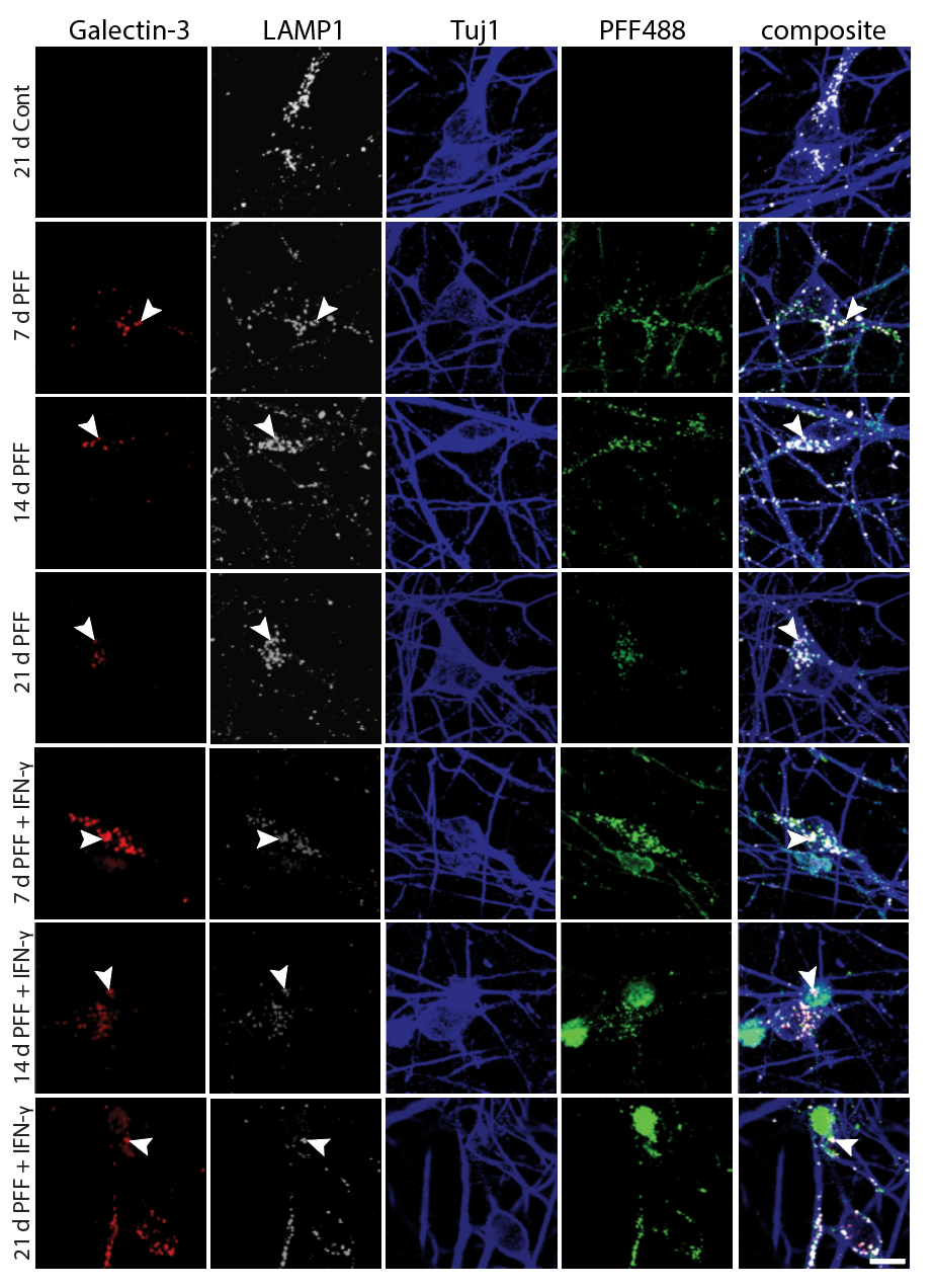 Galectin-3 puncta on ruptured lysosomes