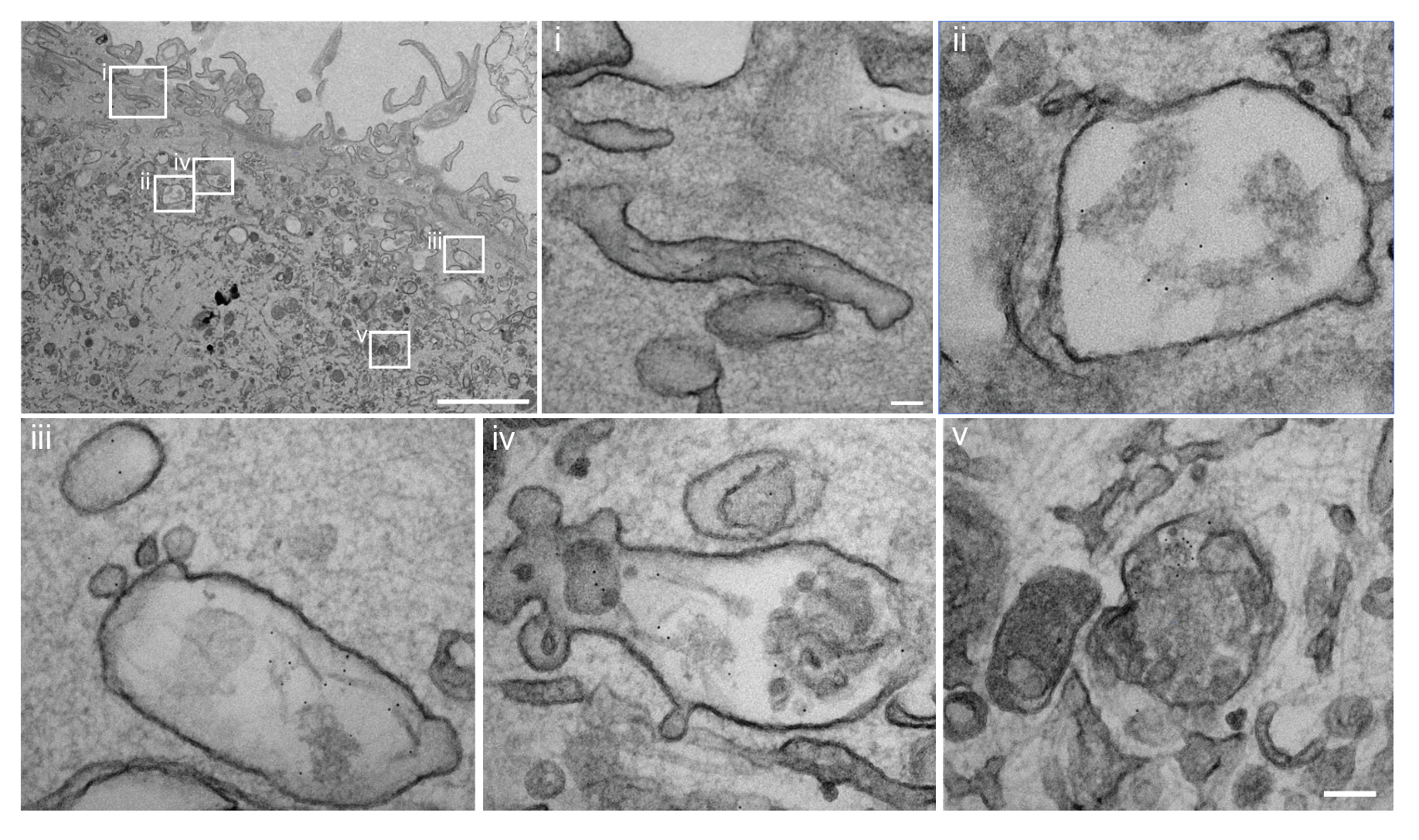 Nanogold-labeled PFFs tracked from cell surface (i) to macropinosomes (ii–iii) to lysosomes (iv–v)