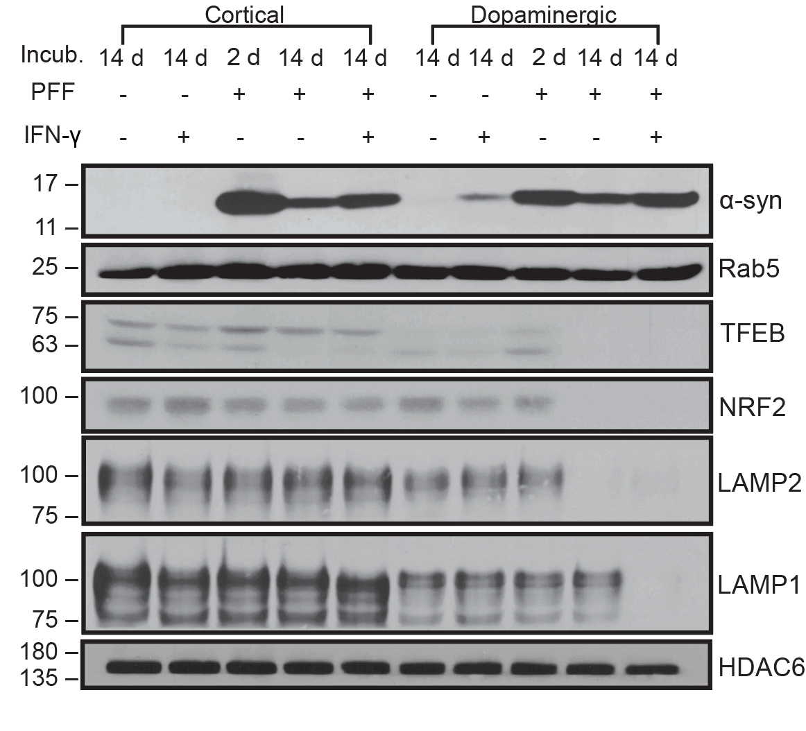 Western blots: LAMP1, LAMP2, TFEB, NRF2 across conditions