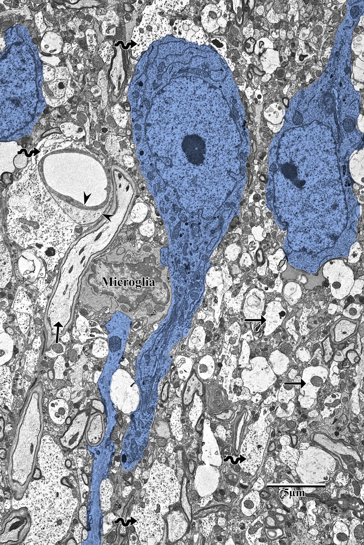 Control pyramidal neurons with healthy round morphology in contralateral SSC