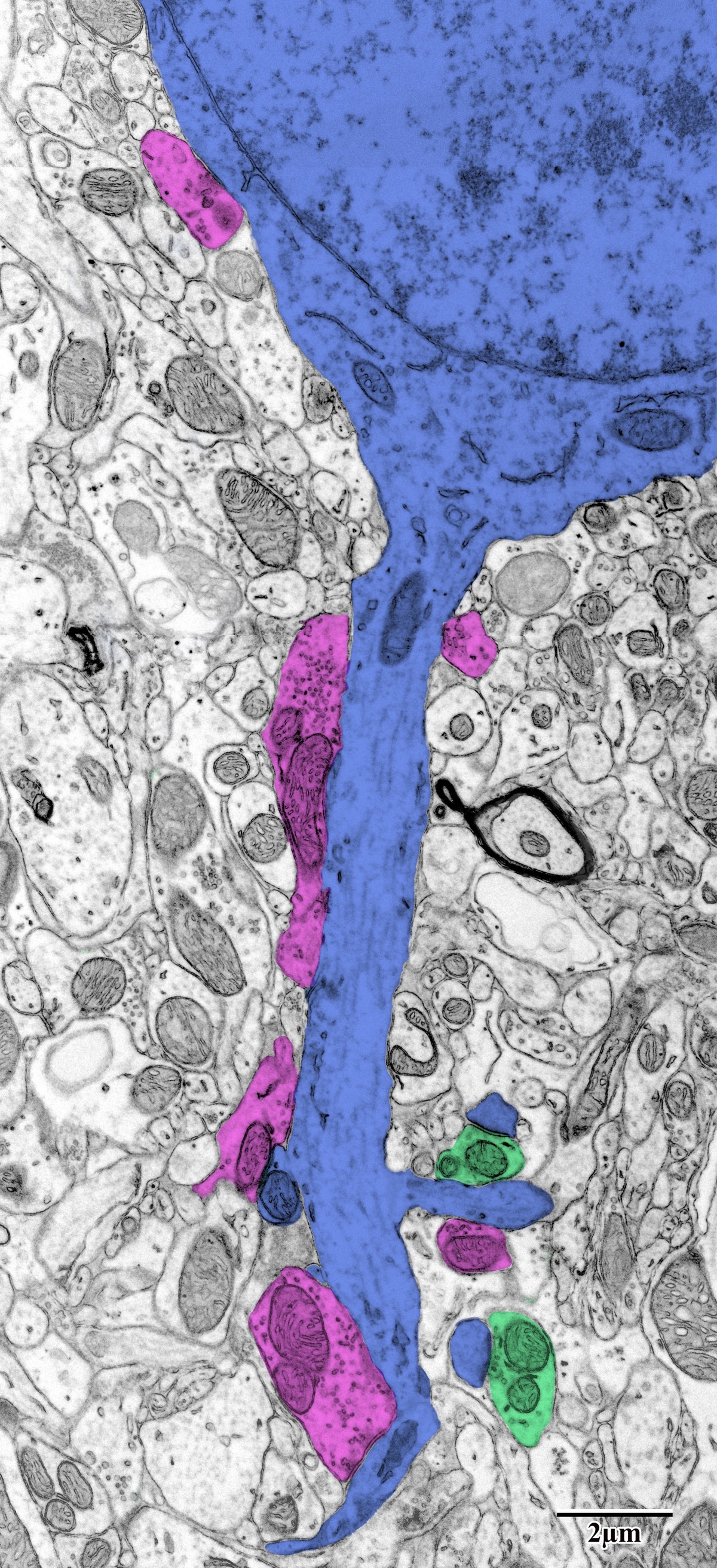 Pseudocolored pyramidal neuron dendrite with synaptic contacts
