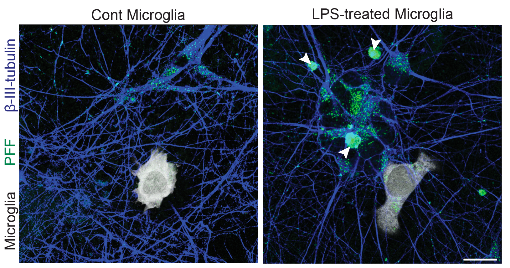 Neuron–microglia co-culture: accelerated α-syn inclusion formation