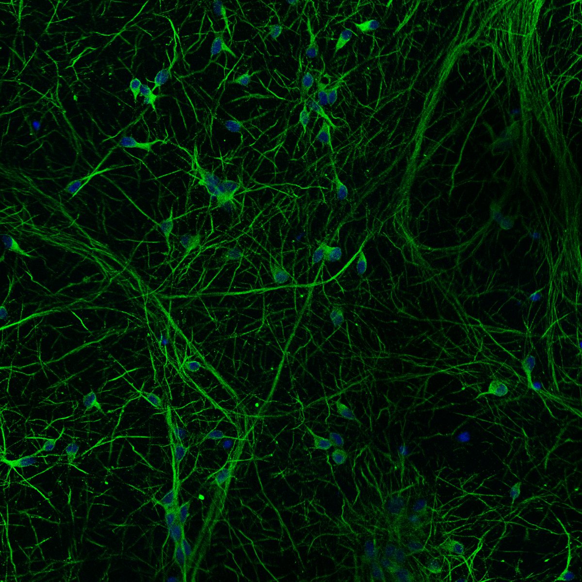 Cortical neurons: MAP2 neuronal network with DAPI nuclear stain