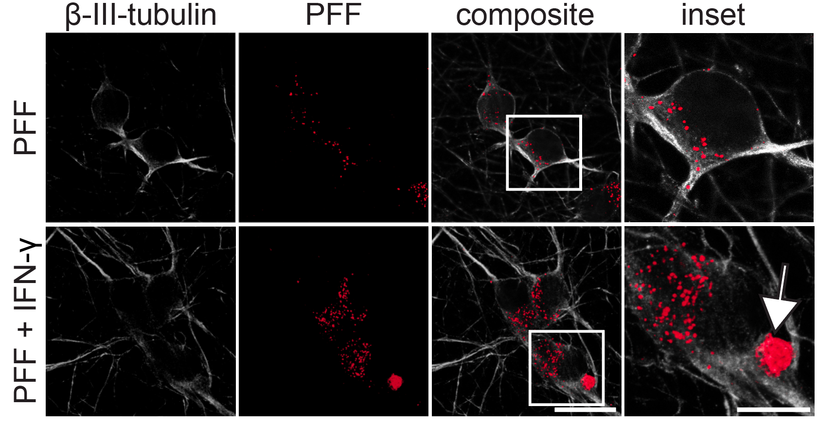 Confocal: PFF-only vs PFF + IFN-γ dual-hit comparison