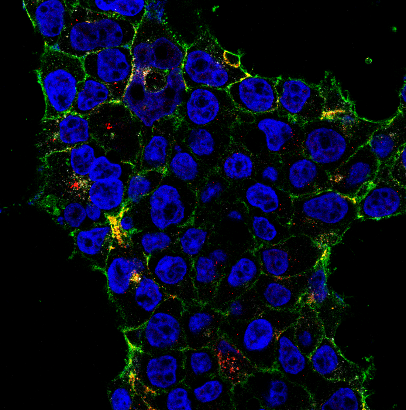 Confocal: SARS-CoV-2 spike protein surface binding and internalization
