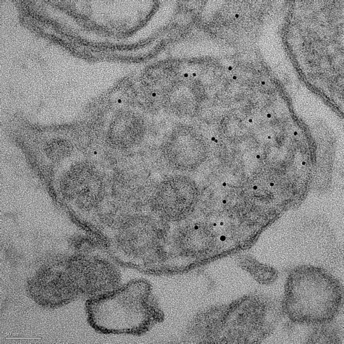 TEM 98000X showing nanogold-labeled alpha-synuclein fibrils in lysosome