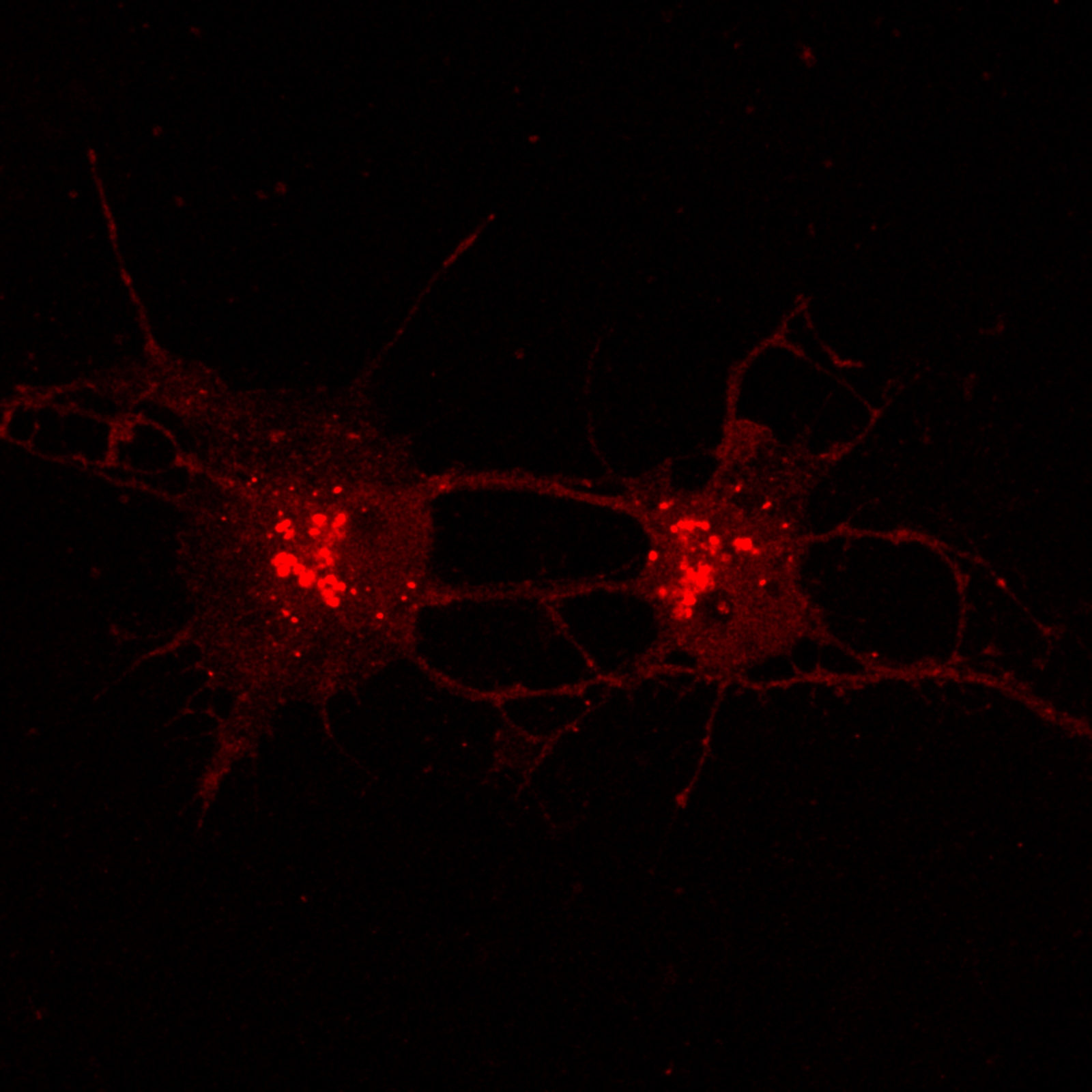 Primary rat hippocampal neuron — 10-minute LysoTracker exposure showing expanded lysosomal network